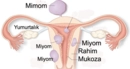 Kist Miyom Belirtileri ve Tedavisi Kist Miyom Belirtileri ve Tedavisi