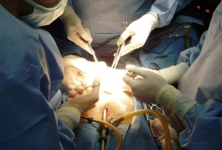 Kist Ameliyatı Sonrası Kist Ameliyatı Sonrası