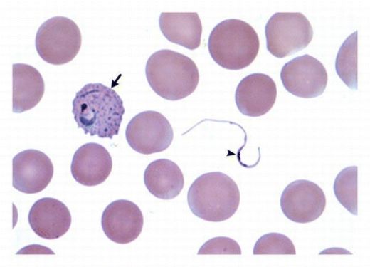 Plasmodium Vivax